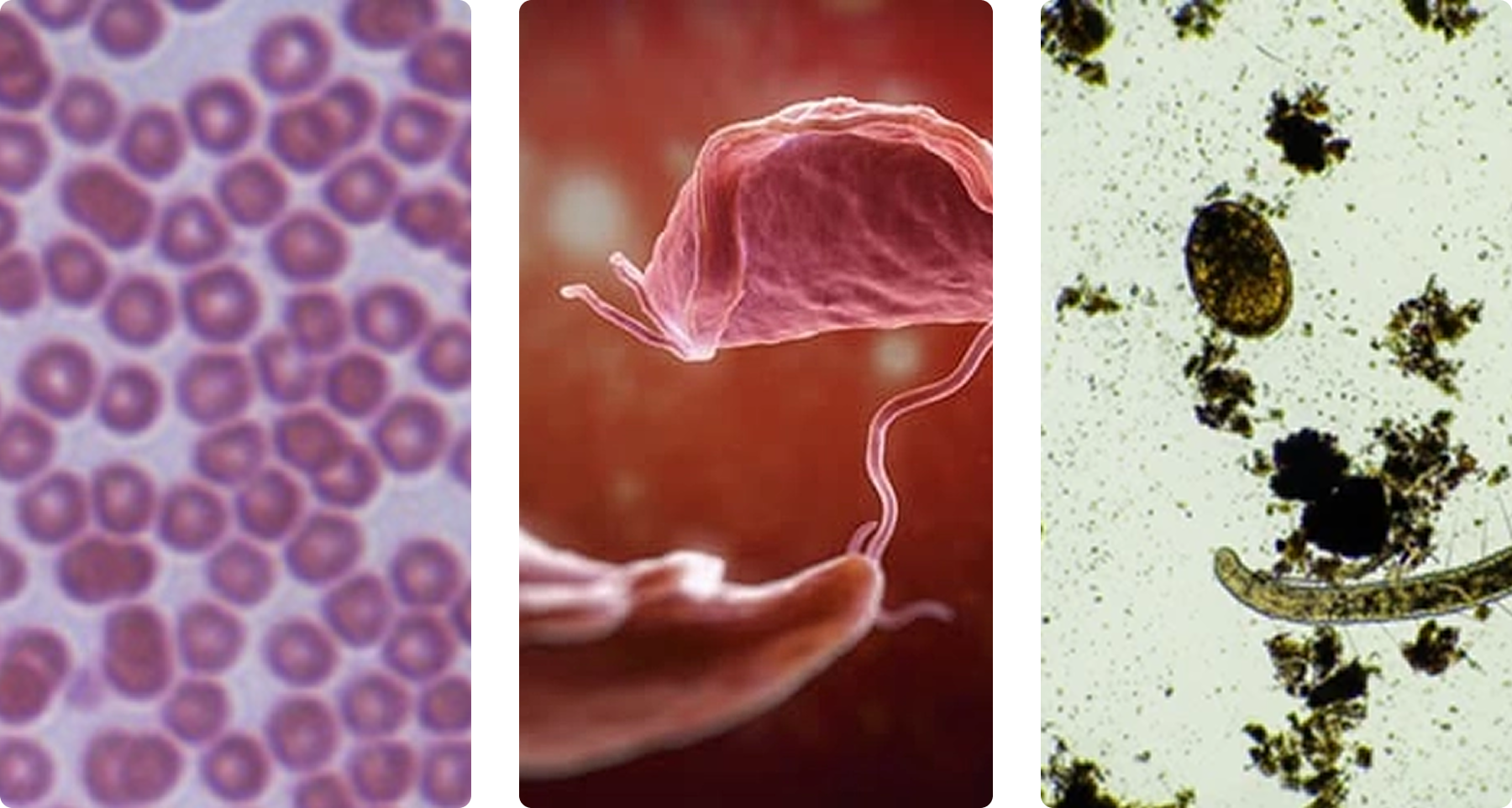 Three micrographs of biological samples on a white background