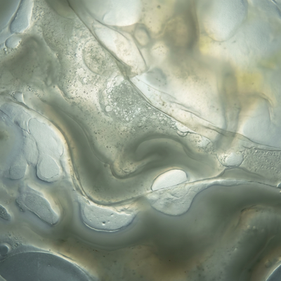 Your Gut Floods the Lymph